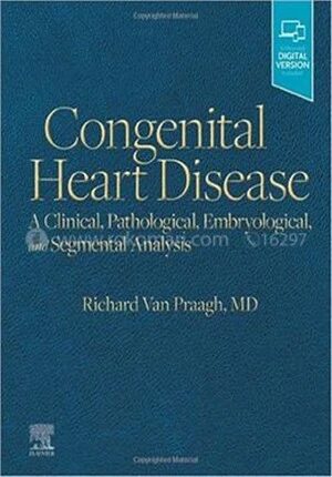 Congenital Heart Disease