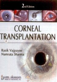 Corneal Transplantation