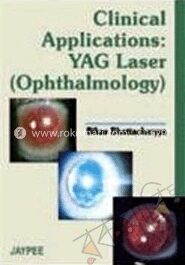 Clinical Application YAG Laser (Ophthalmology)