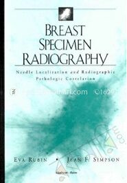 Breast Specimen Radiography