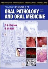 Cawson's Essentials of Oral Pathology