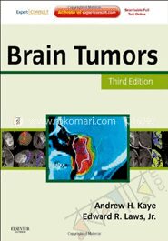 Brain Tumors