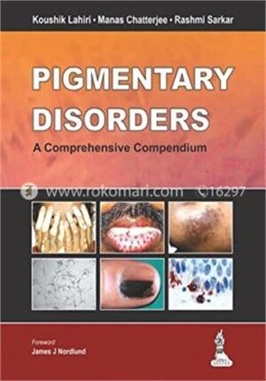 Pigmentary Disorders
